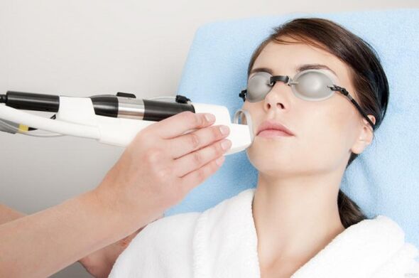 conducting a procedure for laser skin rejuvenation