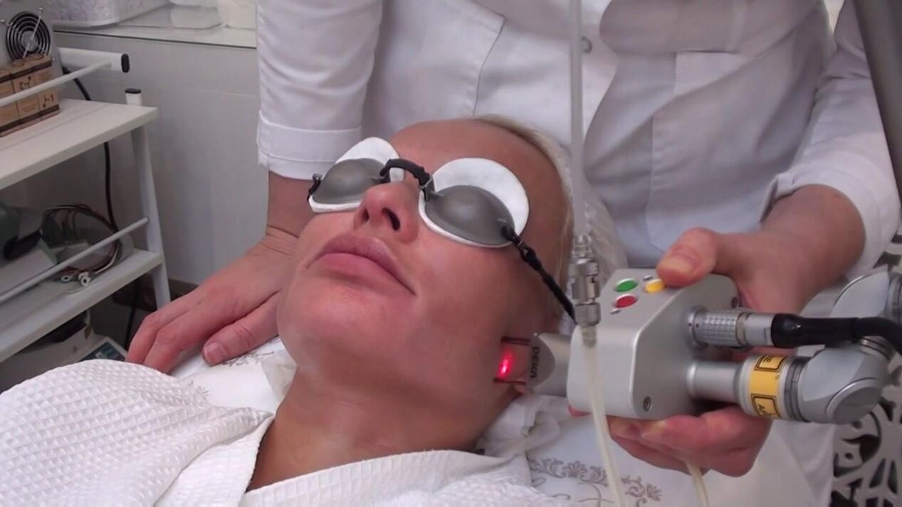 Laser treatment of problem areas of facial skin