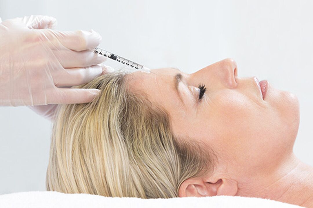 Plasmolifting is an injection method to rejuvenate facial skin