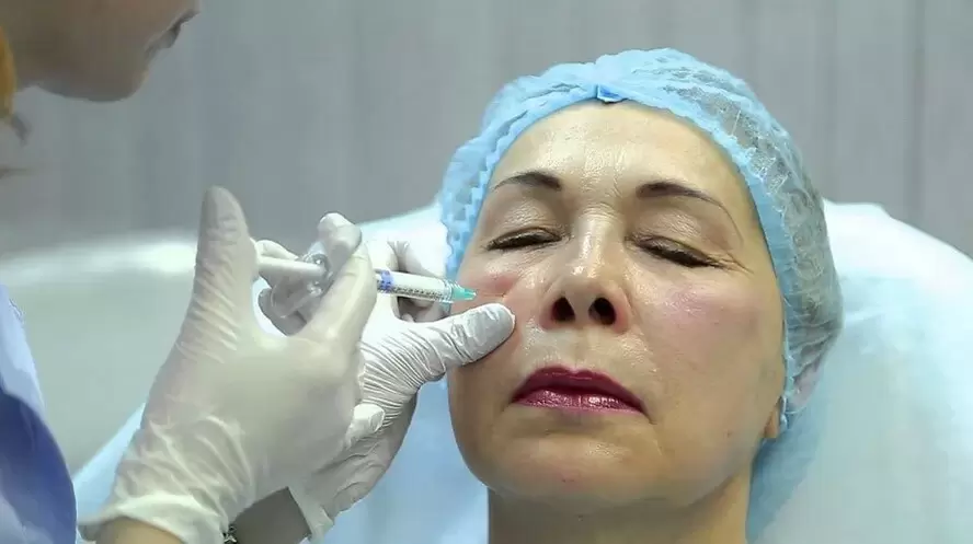 bioreinforcement for facial rejuvenation