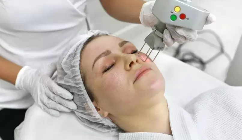 laser facial rejuvenation